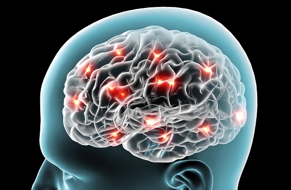 Medley SD b brain