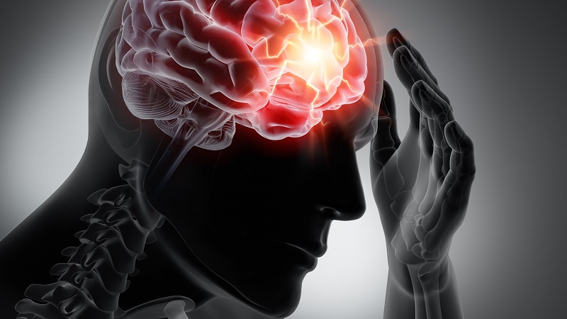 brain injuries